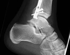 Biomechanics research