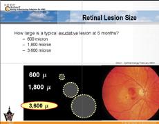Educating eye doctors